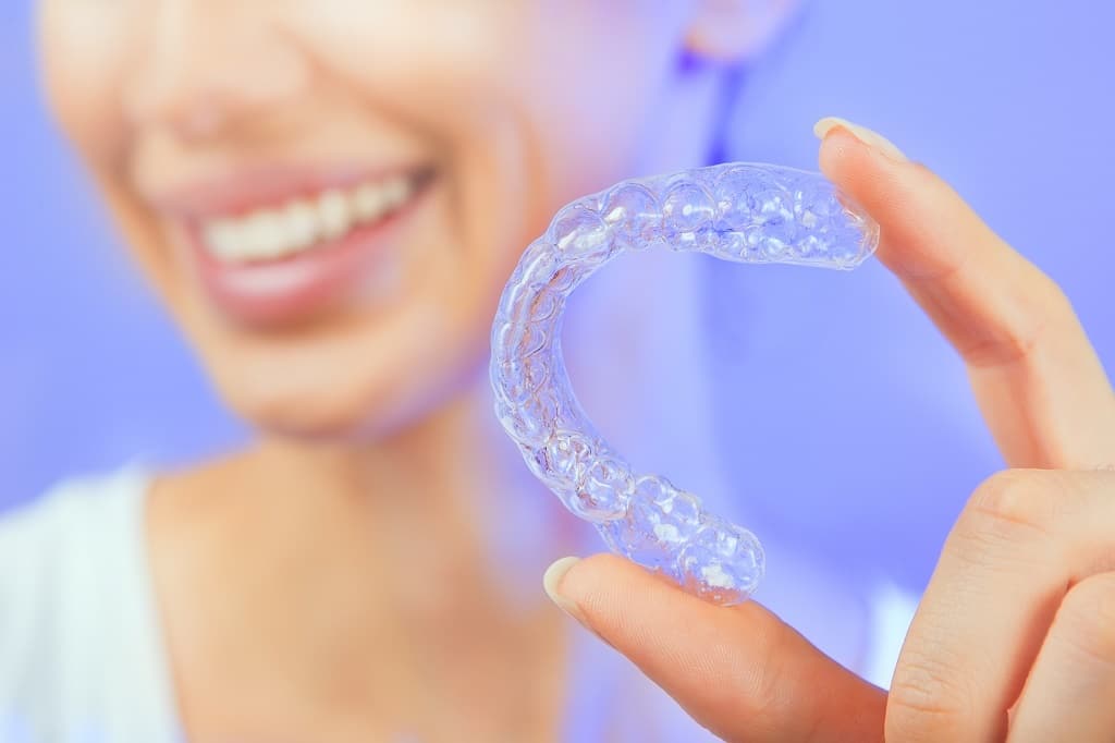 Invisalign Process